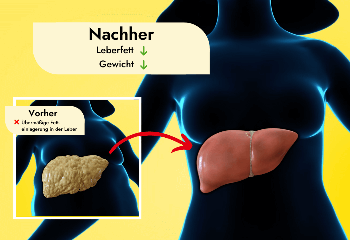 Grafische Darstellung von einer Fettleber als "Vorher"-Zustand sowie einer gesunden Leber und einer Gewichtsabnahme als "Nachher"-Zustand.