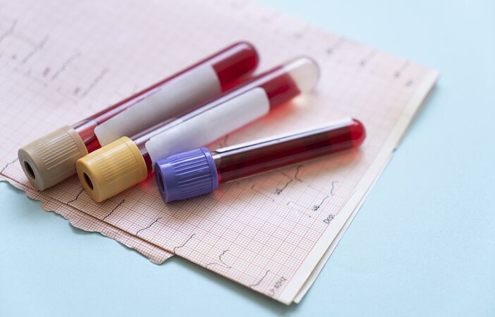 blutproben-auf-tisch-fuer-stoffwechsel-test